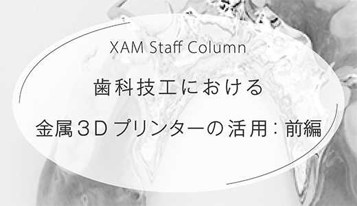 歯科技工における金属3Dプリンターの活用とは？：前編