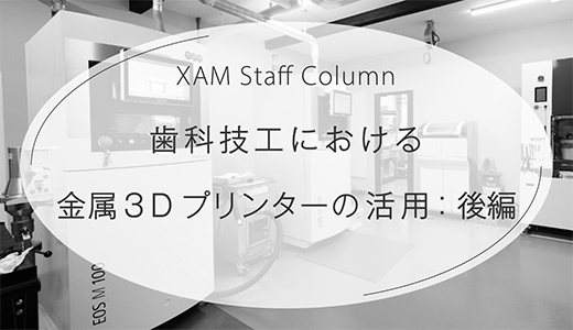 歯科技工における金属3Dプリンターの活用とは？：後編